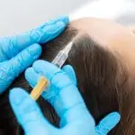 Saç Mezoterapisi Nedir Nasıl Yapılır