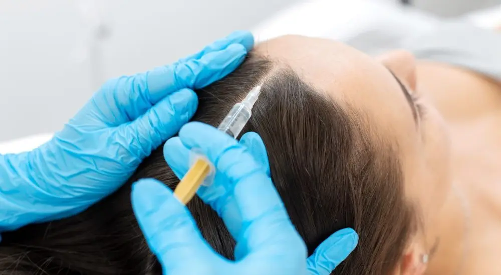 Saç Mezoterapisi Nedir Nasıl Yapılır