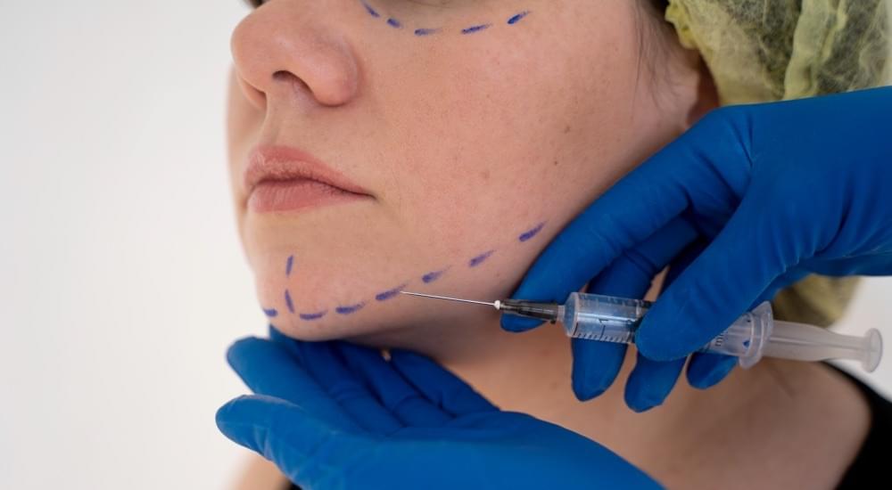 Çene Dolgusu Nedir Nasıl Uygulanır