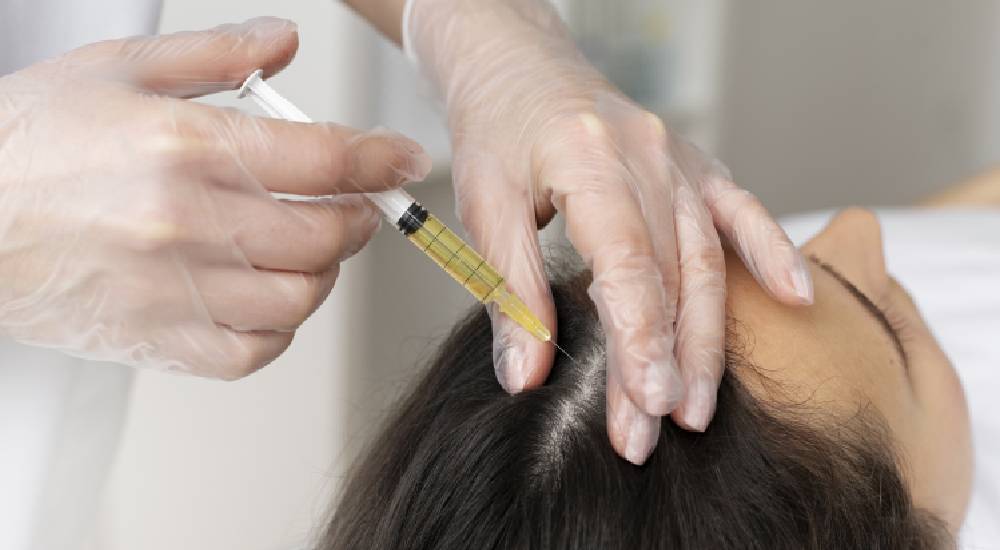 Saç Mezoterapisi Ne İşe Yarar