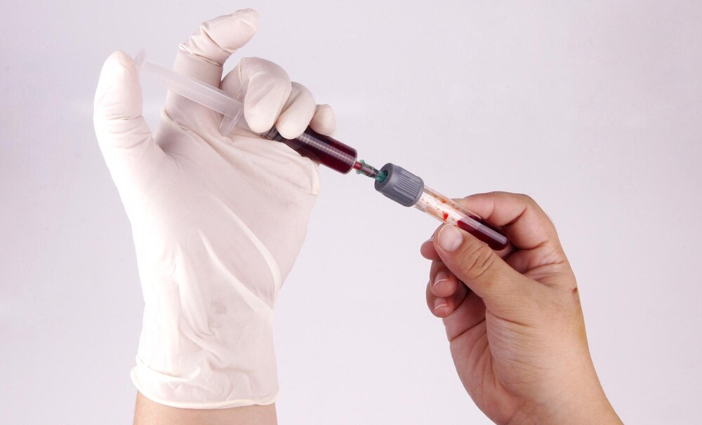 close-up-hand-injecting-blood-sample-into-test-tube_1048944-19272065.jpg